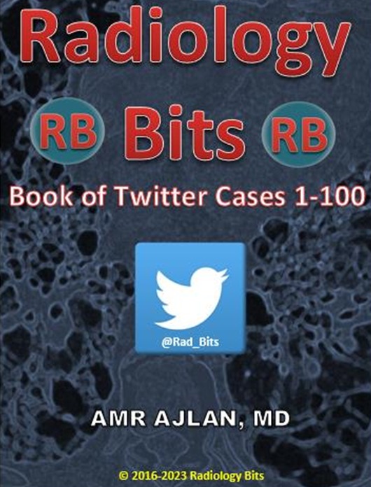 Radiology Bits Book of Twitter Cases 1-100